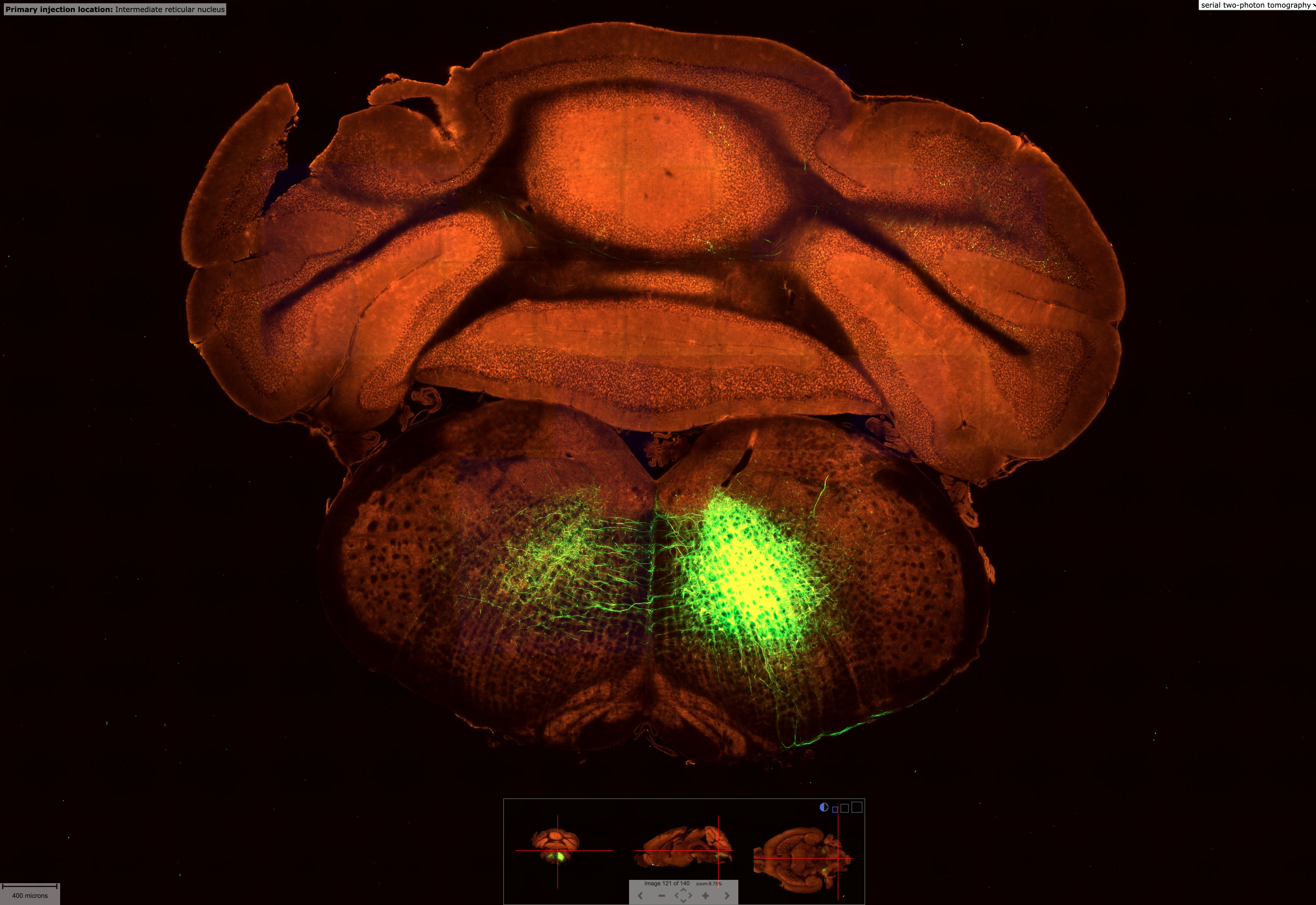 MICrONS Explorer: A virtual observatory of the cortex - The BRAIN